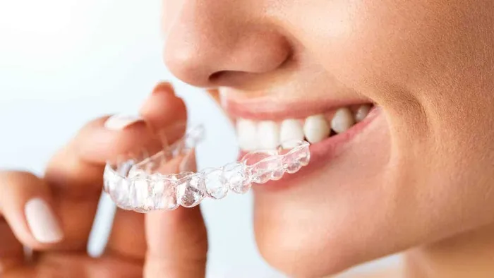 Man putting in Invisalign clear aligner
