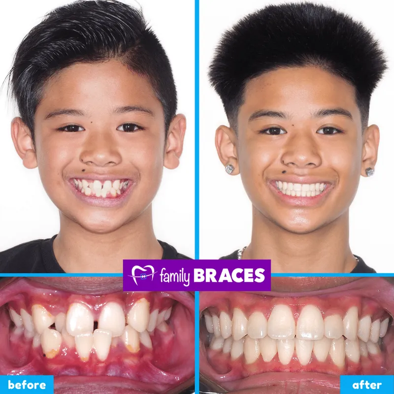 Before & after result 2
