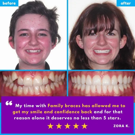 Family Braces Instagram post