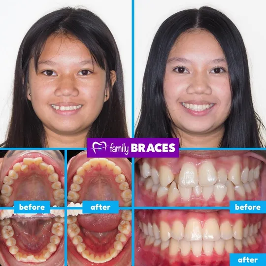 Family Braces Instagram post