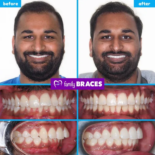 Family Braces Instagram post