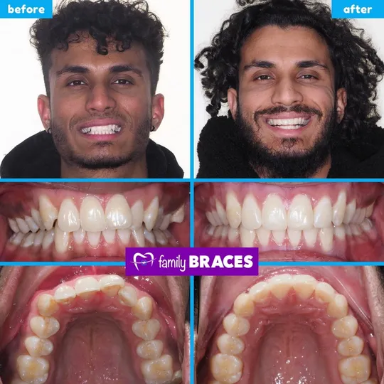 Family Braces Instagram post