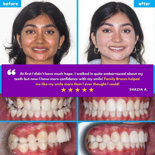 Family Braces Instagram post