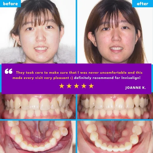 Family Braces Instagram post