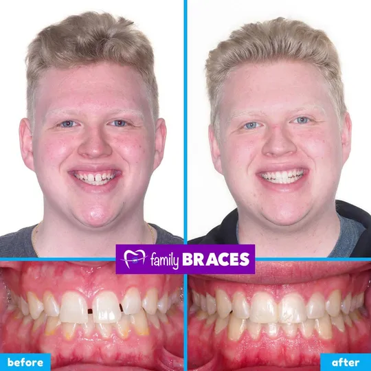 Family Braces Instagram post