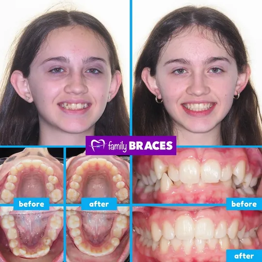 Family Braces Instagram post