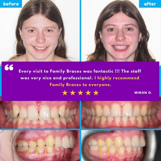 Family Braces Instagram post