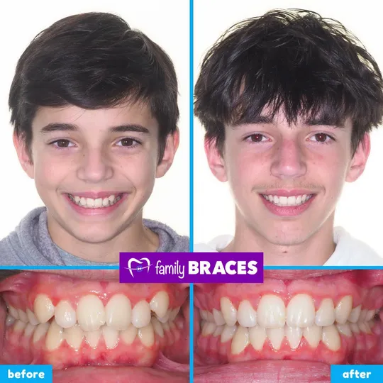 Family Braces Instagram post