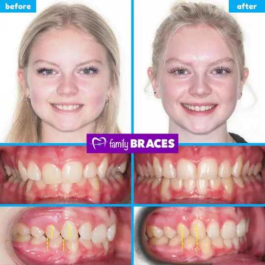 Family Braces Instagram post