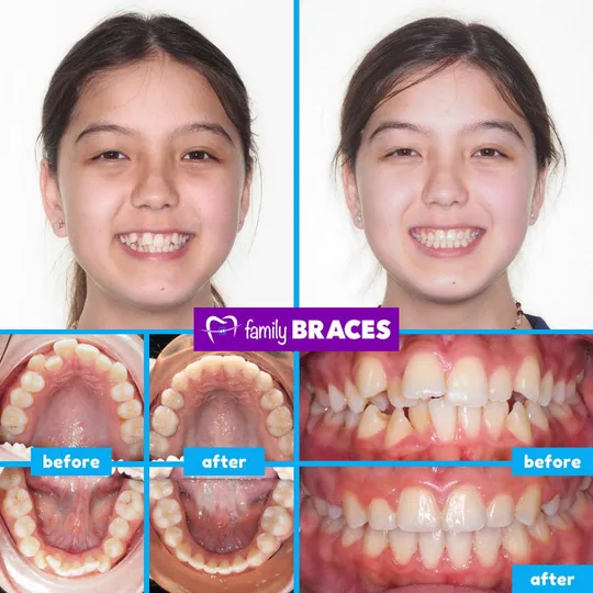 Family Braces Instagram post