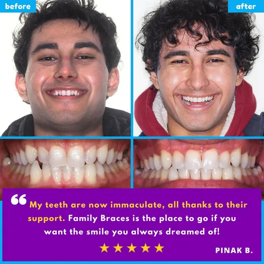 Family Braces Instagram post