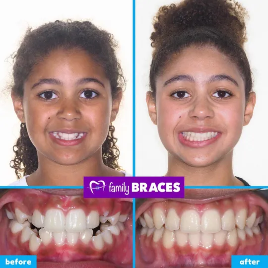 Family Braces Instagram post