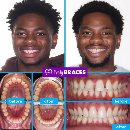 Family Braces Instagram post