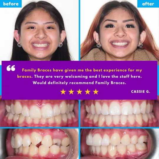 Family Braces Instagram post