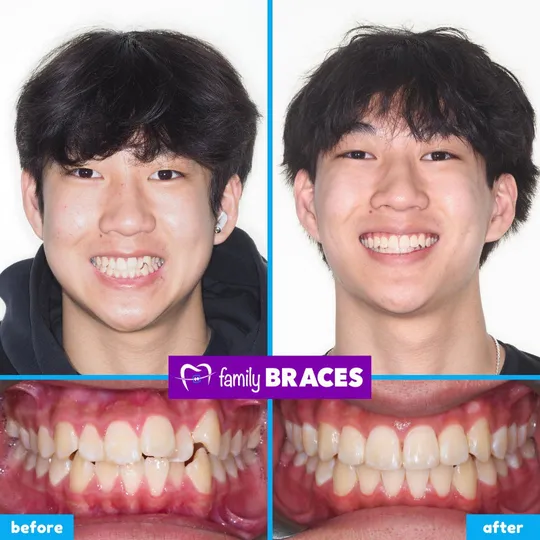 Family Braces Instagram post